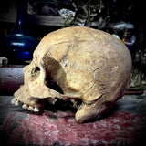 Human skull