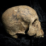 Human skull