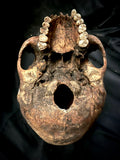 A human skull