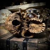 Human skull