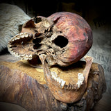 Human skull with mandible