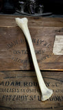 Human tibia (shinbone)