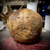 Human skull with trauma