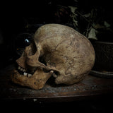 Human skull