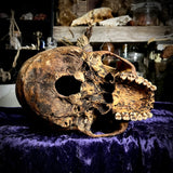 Human skull