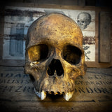 Human skull