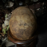Human skull