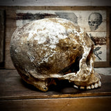 Human skull