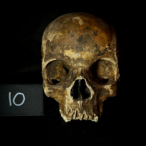 Item 10. Human skull