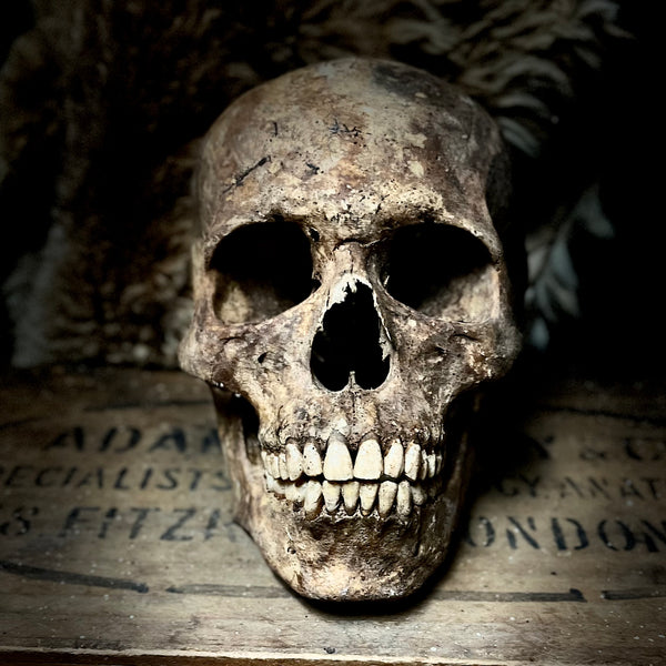 Human skull with mandible.