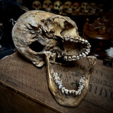 Human skull with mandible