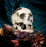 Medically prepared human skull