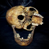 Item 11. Human skull with mandible