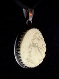 Item 15. Skull cap suture pendant