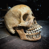 Human skull