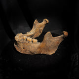 A mandible
