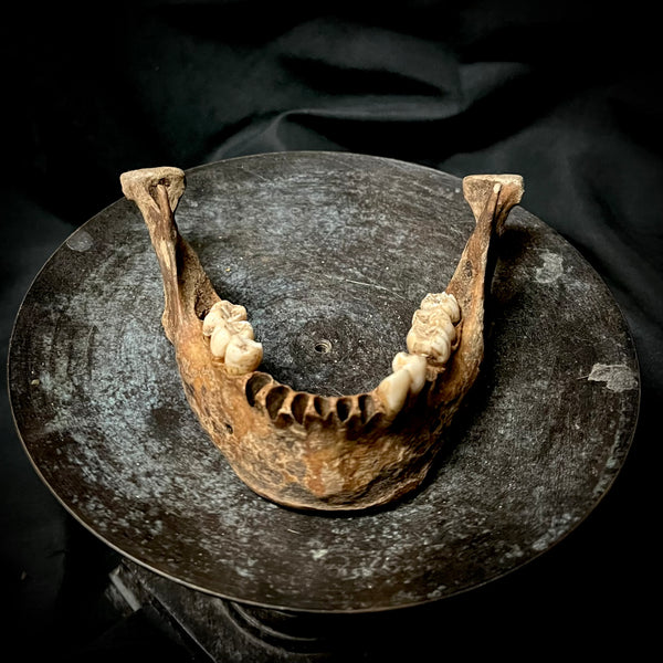 A mandible