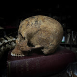 Human skull