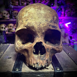 Human skull