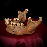 A mandible