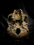 Human skull