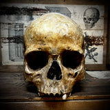 Human skull