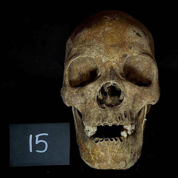 Item 15. Human skull with mandible