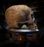 A human skull