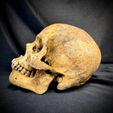 Item 1. Human skull with mandible