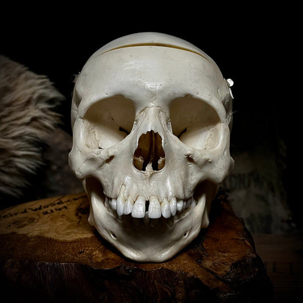 Human child skull