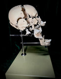 Adam Rouilly Exploded skull
