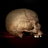 Human Skull