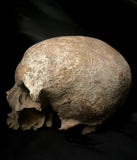 A human skull