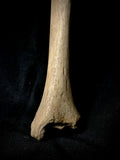 Human tibia (shinbone)