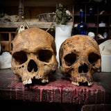 Large human skull
