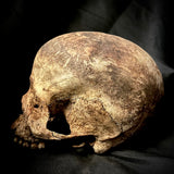 A human skull