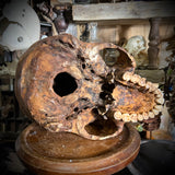 Human skull