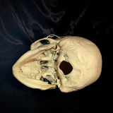Item 5. Human medical skull