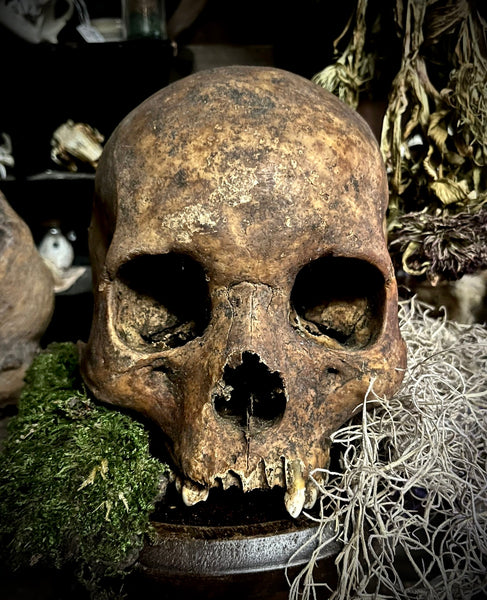 A human skull