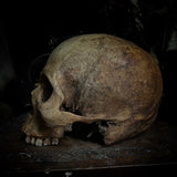 Human skull