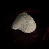 Adam Rouilly Human Kneecap