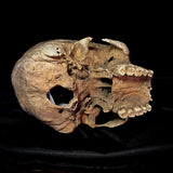 Item 20. Human skull