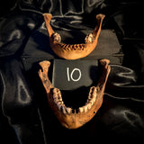 Item 10. Two human mandibles