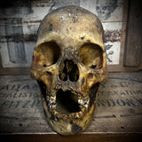 Human skull with mandible