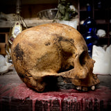 Human skull with trauma