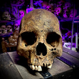 Human skull