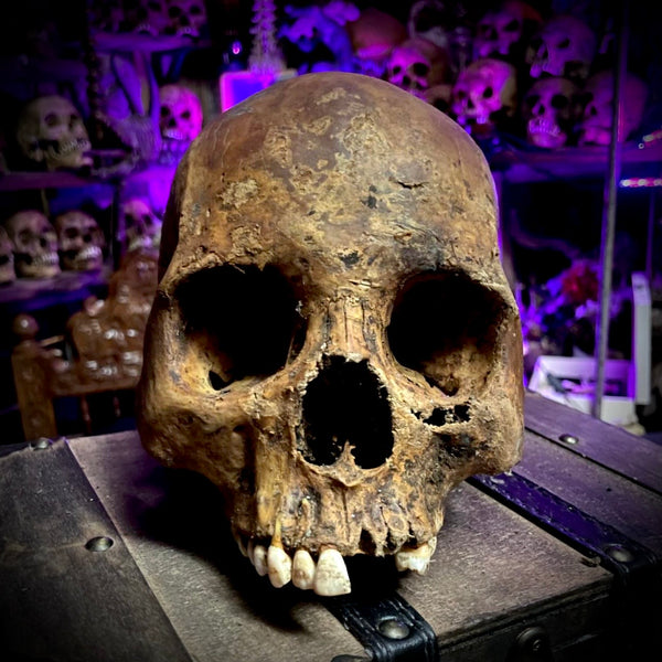 Human skull
