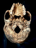 A human skull