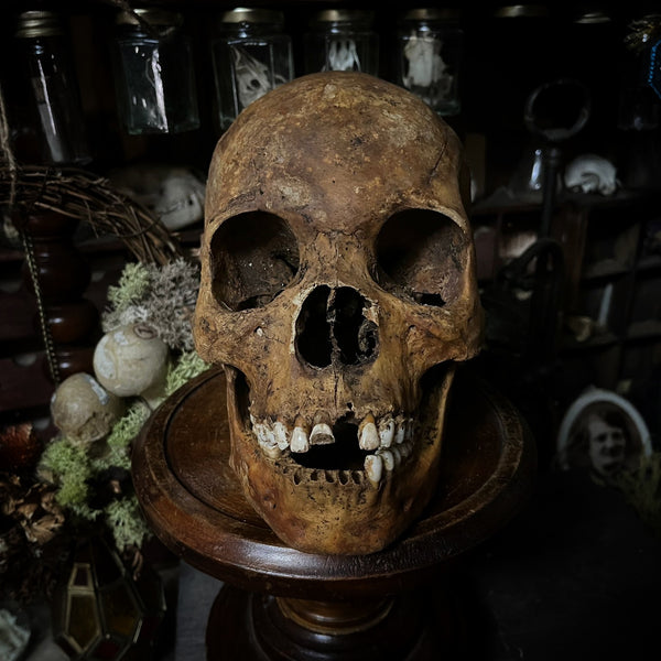 Human skull