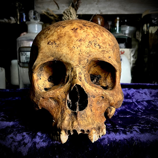 Human skull